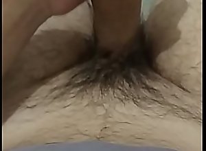 Vitiligo penis amateur
