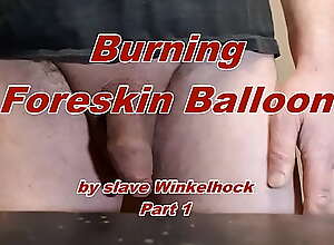Foreskin balloon for slave Winkelhock Part1